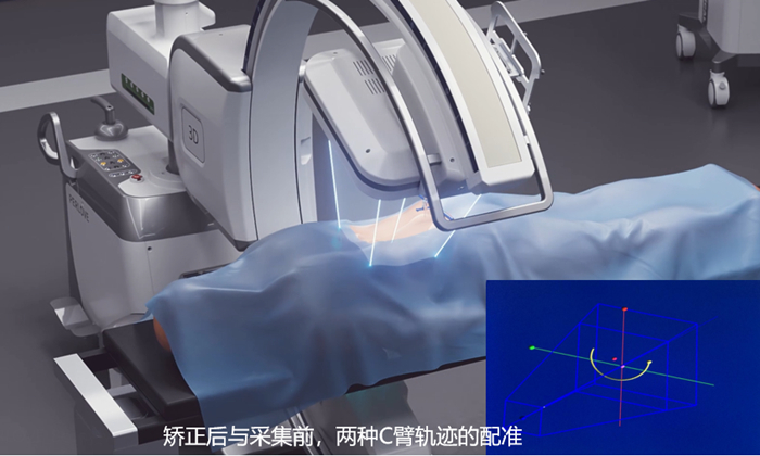 什么是骨科手術(shù)導(dǎo)航定位系統(tǒng)配準 一體化自適應(yīng)配準有什么優(yōu)勢